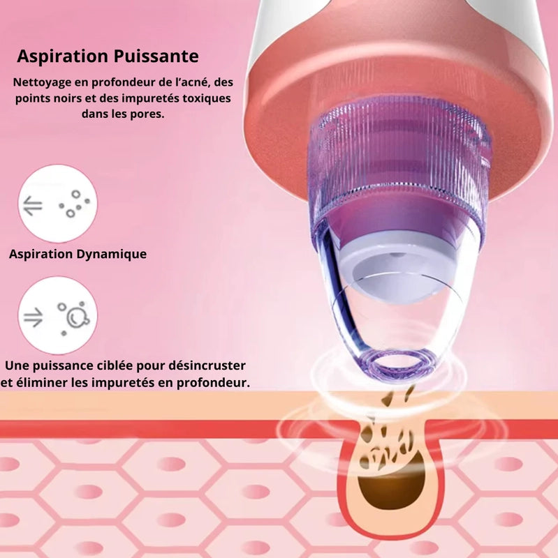 XR CLEANER : Aspirateur de points noirs