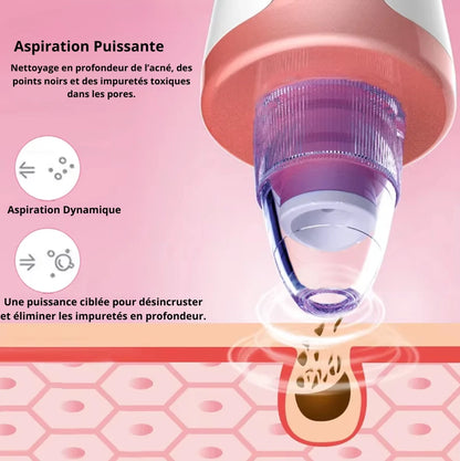 XR CLEANER : Aspirateur de points noirs